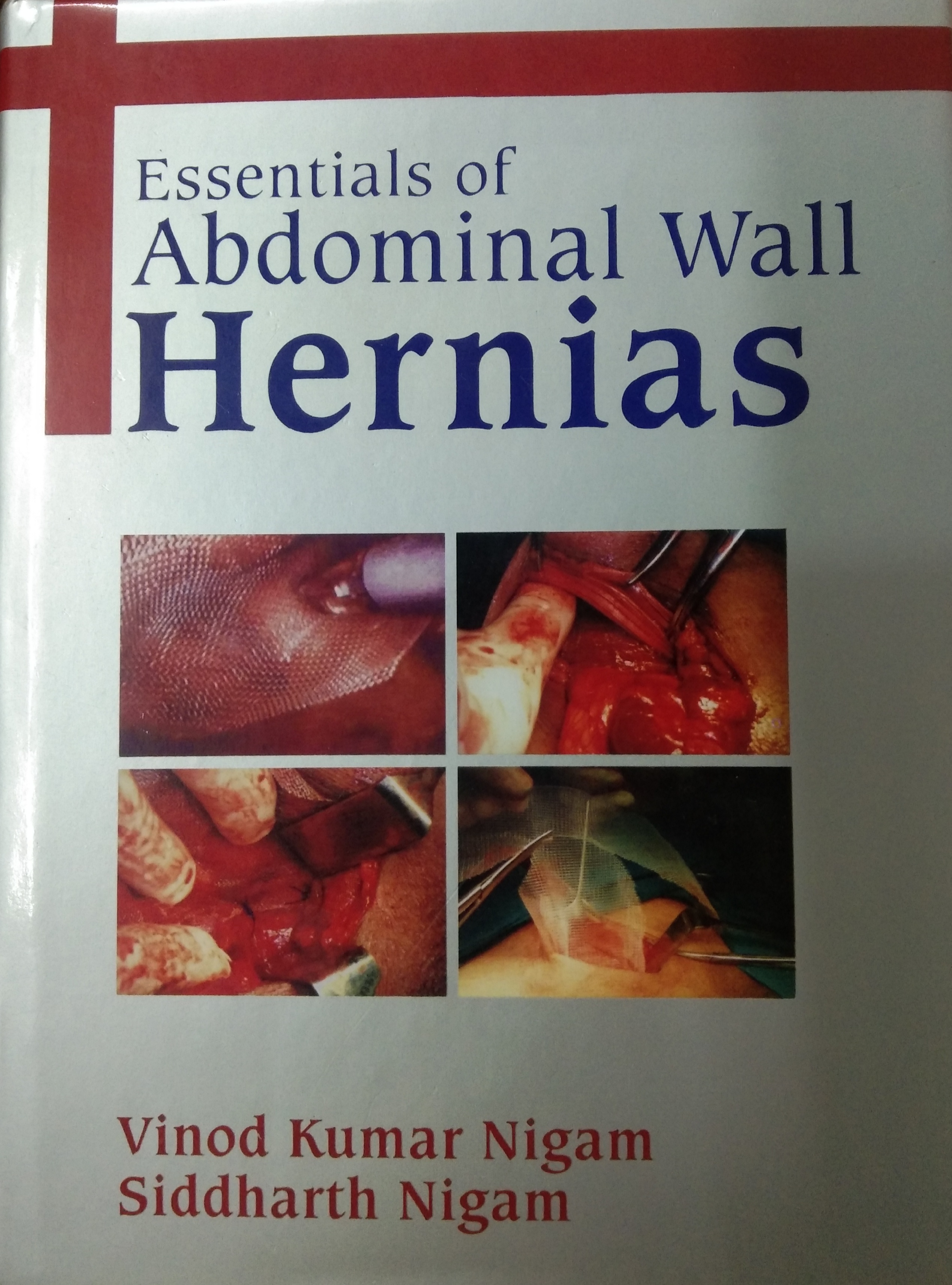 ESSENTIALS OF ABDOMINAL WALL HERNIAS WITH CD-ROM
