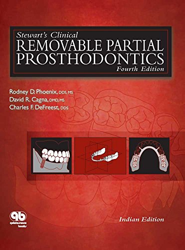 

general-books/general/stewart-s-clinical-removable-partial-prosthodontics-4-ed--9788192297743