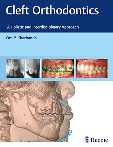 

exclusive-publishers/thieme-medical-publishers/cleft-orthodontics-a-holistic-and-interdisciplinary-approach--9788194857082