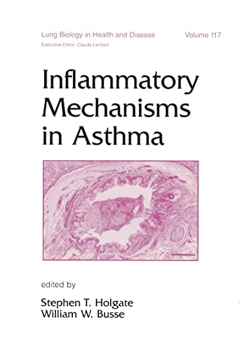 

special-offer/special-offer/inflammatory-mechanisms-in-asthma-lung-biology-in-health-disease-lung--9780824701222