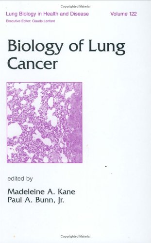 

special-offer/special-offer/lung-biology-in-health-and-disease-vol-122-biology-of-lung-cancer--9780824701321