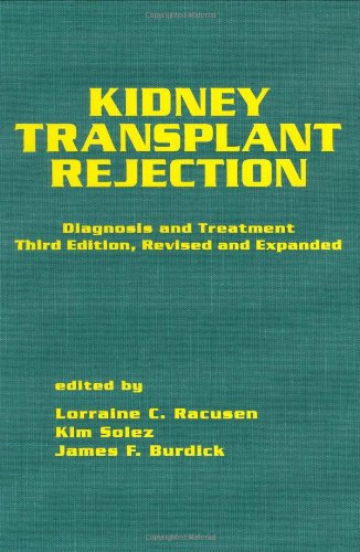 

special-offer/special-offer/kidney-transplant-rejection-3-ed--9780824701390