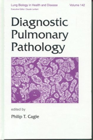 

special-offer/special-offer/lung-biology-in-health-disease-vol-142-diagnostic-pulmonary-pathology--9780824701680
