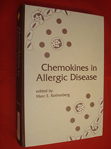 

special-offer/special-offer/chemokines-in-allergic-disease--9780824702861