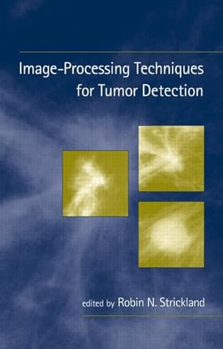

special-offer/special-offer/image-processing-techniquies-for-tumor-detection--9780824706371