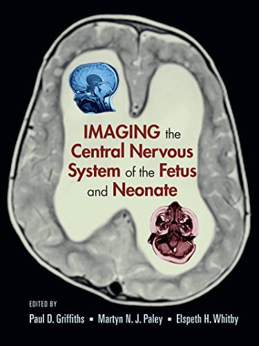

special-offer/special-offer/imaging-the-central-nervous-system-of-the-fetus-and-neonate--9780824728564