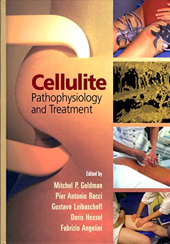 

special-offer/special-offer/cellulite-pathophysiology-and-treatment-basic-and-clinical-dermatology--9780824729851
