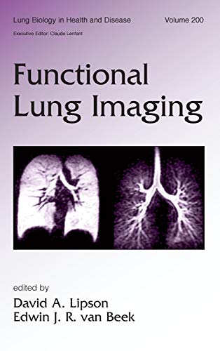 

special-offer/special-offer/lung-biology-in-health-and-disease-functional-lung-imaging-vol-200--9780824754273