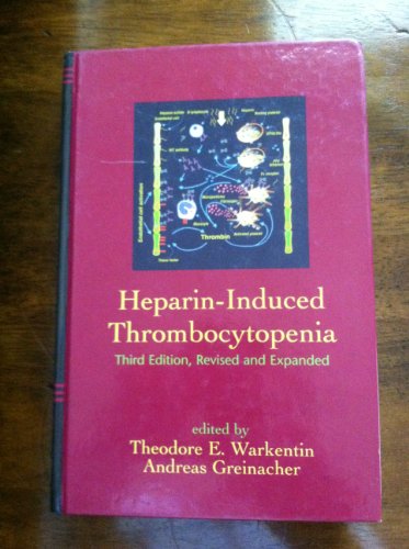 

special-offer/special-offer/heparin-induced-thrombocytopenia-3ed--9780824756253