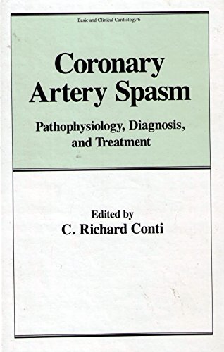 

special-offer/special-offer/coronary-artery-spasm-pathophysiology-diagnosis-and-treatment-basic-and-clinical-cardiology-series-vol-6--9780824773793