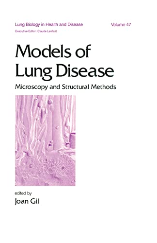 

special-offer/special-offer/models-of-lung-disease-lung-biology-in-health-and-disease--9780824780968