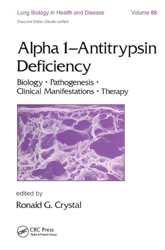 

special-offer/special-offer/lung-biology-in-health-and-disease-vol-88-alpha-1---antitrypsin-deficiency--9780824788483