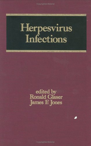 

special-offer/special-offer/herpesvirus-infections-vol-13--9780824788674