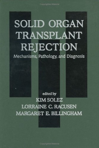 

special-offer/special-offer/solid-organ-transplant-rejection-mechanisms-pathology-and-diagnosis--9780824795108