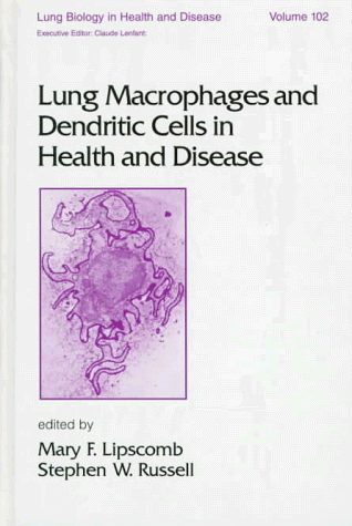 

special-offer/special-offer/lung-macrophages-and-dendritic-cells-in-health-and-disease--9780824798178