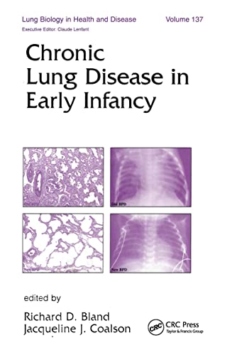 

special-offer/special-offer/lung-biology-in-health-and-disease-vol-137-chronic-lung-disease-in-early-infancy--9780824798710