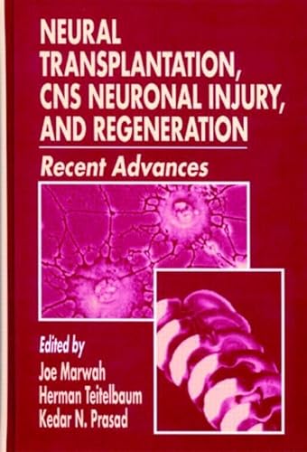 

special-offer/special-offer/neural-transplantation-cns-neuronal-injury-and-regeneration-recent-advance--9780849386831