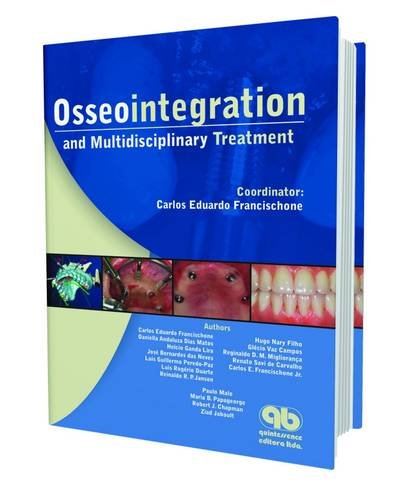 

dental-sciences/dentistry/osseointegration-and-multidisciplinary-treatment-9788587425768