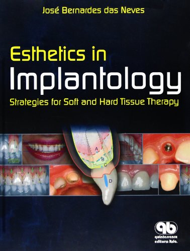 

dental-sciences/dentistry/esthetics-in-implantology-strategies-for-soft-and-hard-tissue-therapy-9788587425911