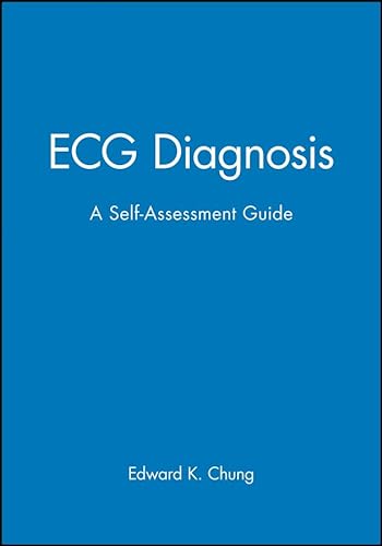 

special-offer/special-offer/ecg-diagnosis-a-self-assessment-workbook--9780865425873