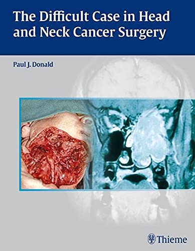 

exclusive-publishers/thieme-medical-publishers/the-difficult-case-in-head-and-neck-cancer-surgery-9780865779846