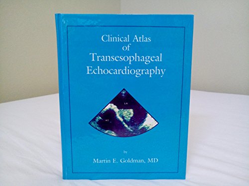 

special-offer/special-offer/clinical-atlas-of-transophageal-echocardiography--9780879935399