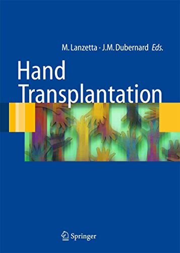 

mbbs/4-year/hand-transplantation-9788847003736