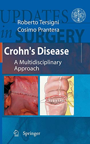 

general-books/general/crohn-s-disease-a-multidisciplinary-approach--9788847014718