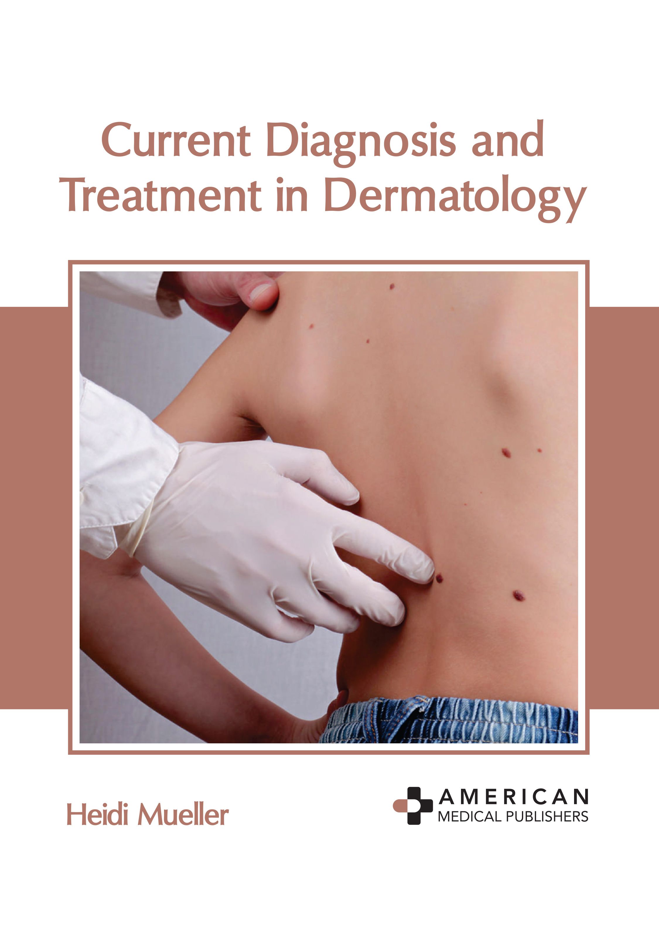 

exclusive-publishers/american-medical-publishers/current-diagnosis-and-treatment-in-dermatology-9798887400297