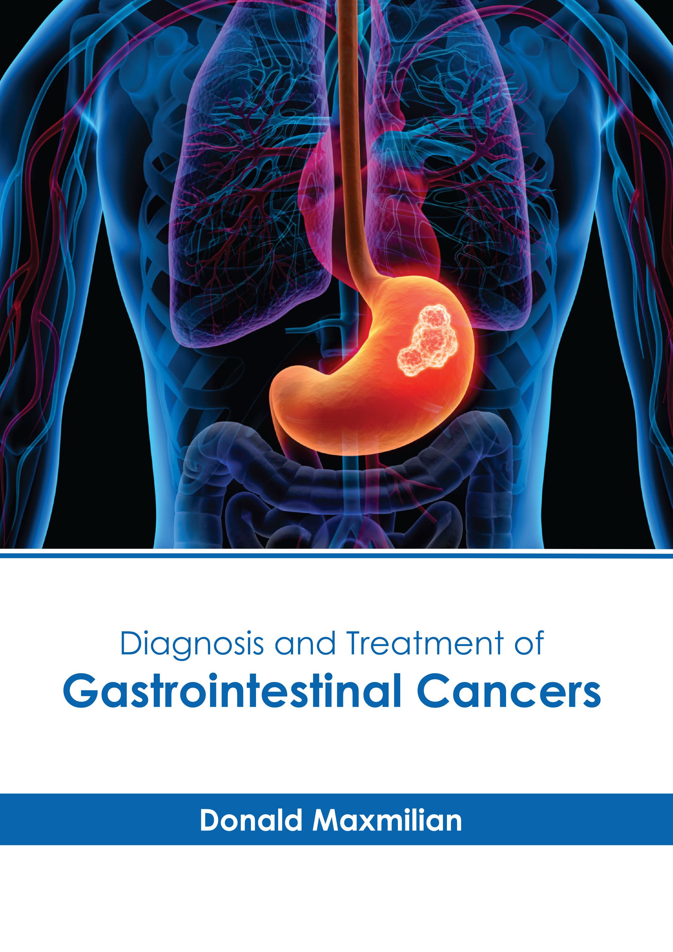 

exclusive-publishers/american-medical-publishers/diagnosis-and-treatment-of-gastrointestinal-cancers-9798887400587