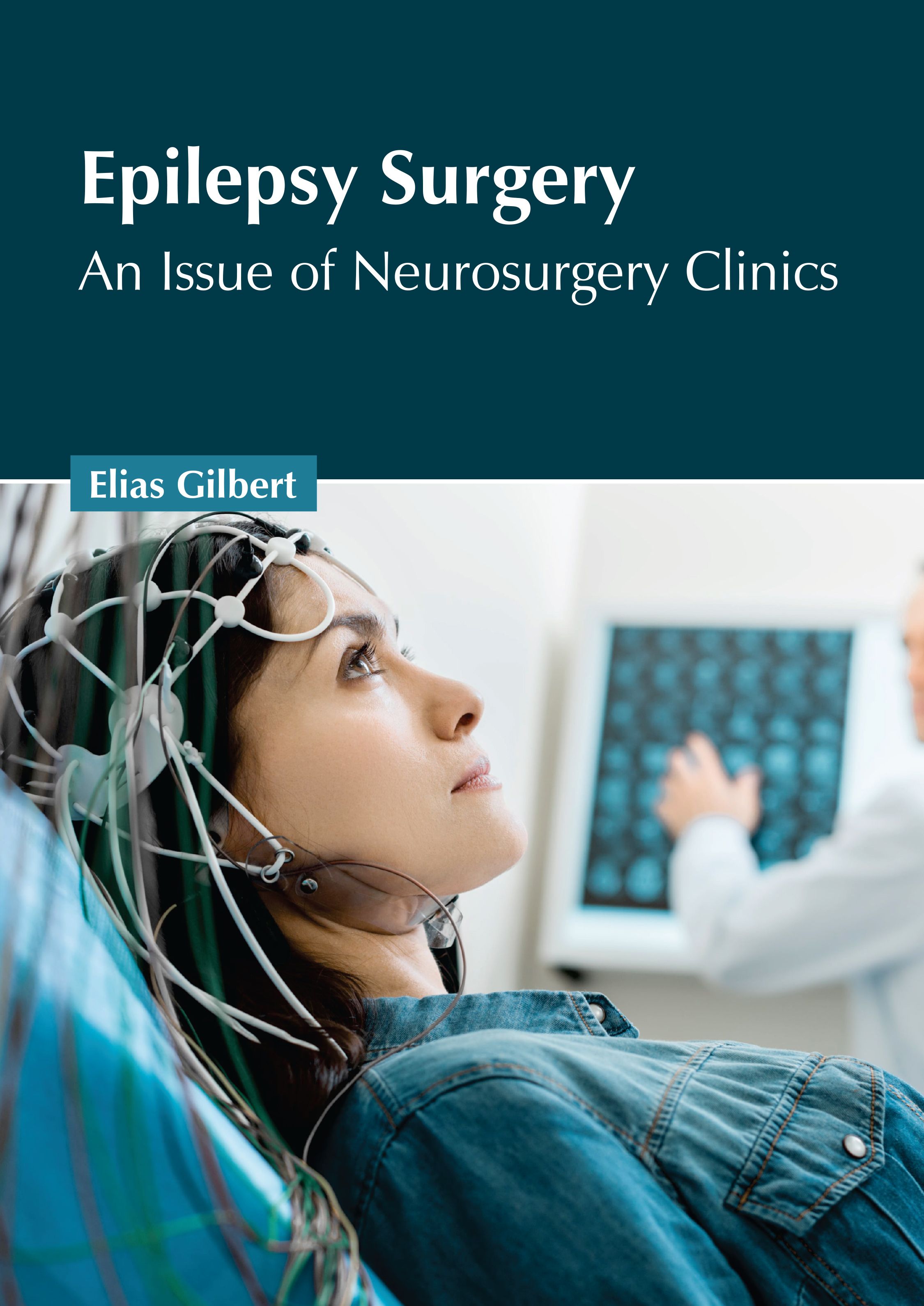 

medical-reference-books/surgery/epilepsy-surgery-an-issue-of-neurosurgery-clinics-9798887400976