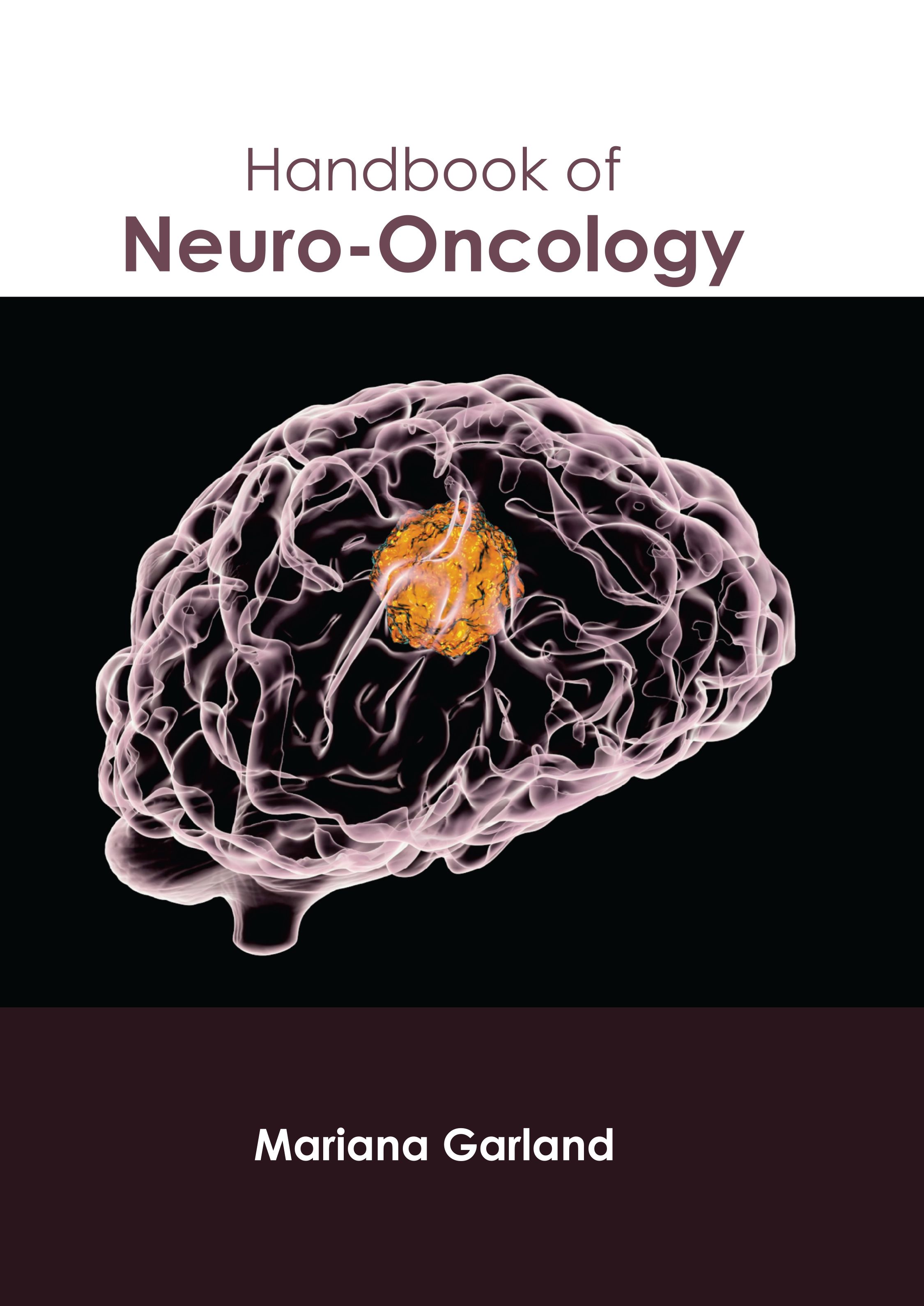 

exclusive-publishers/american-medical-publishers/handbook-of-neuro-oncology-9798887401546