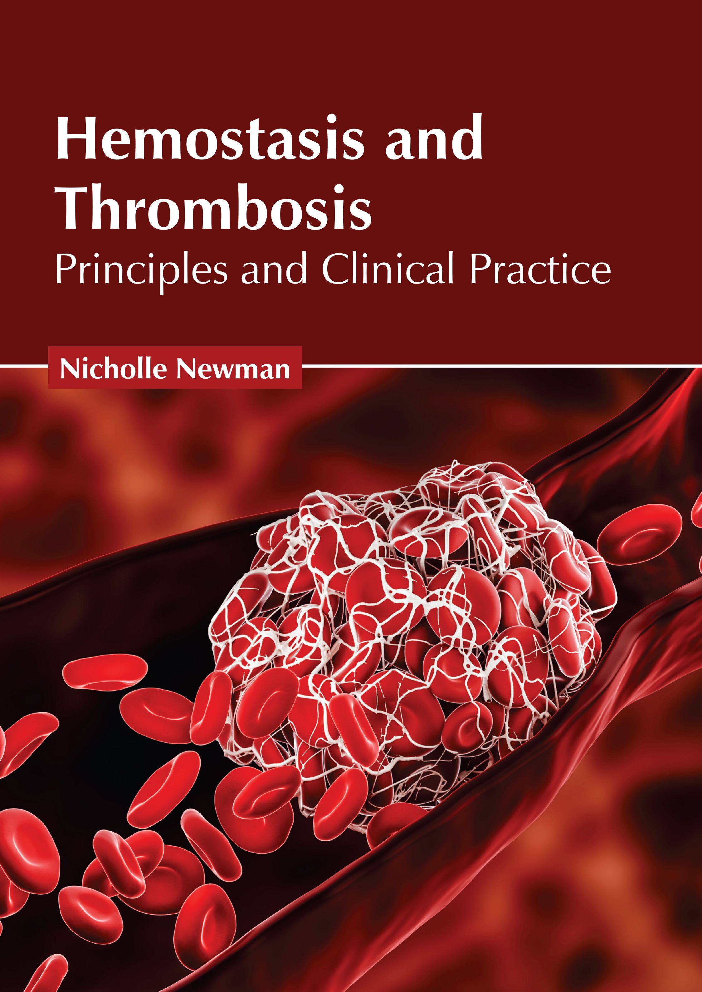 

exclusive-publishers/american-medical-publishers/hemostasis-and-thrombosis-principles-and-clinical-practice-9798887401799