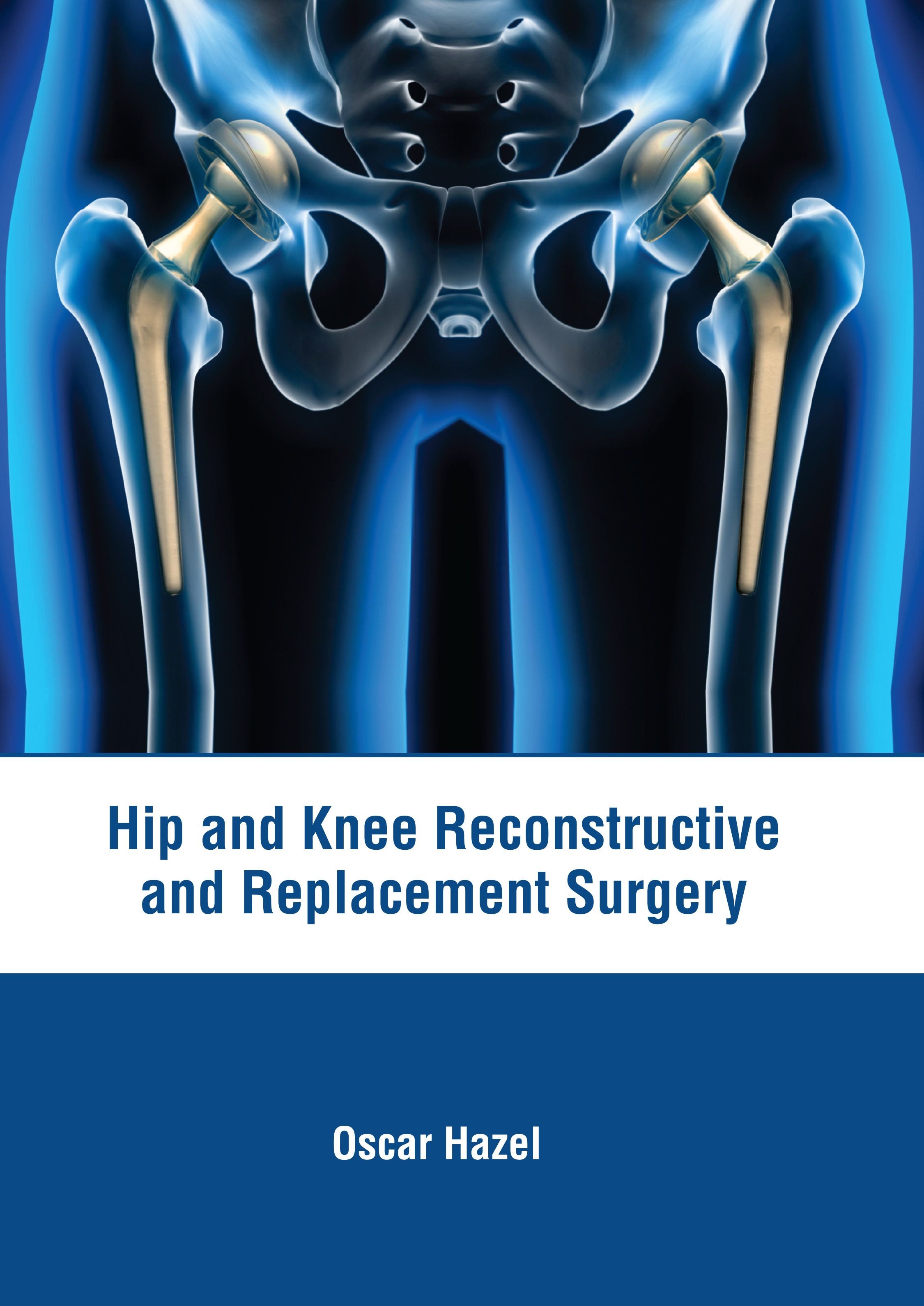 

exclusive-publishers/american-medical-publishers/hip-and-knee-reconstructive-and-replacement-surgery-9798887401836