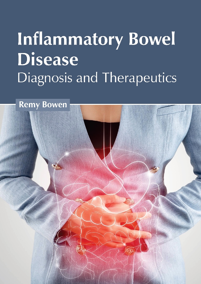 

exclusive-publishers/american-medical-publishers/inflammatory-bowel-disease-diagnosis-and-therapeutics-9798887402130