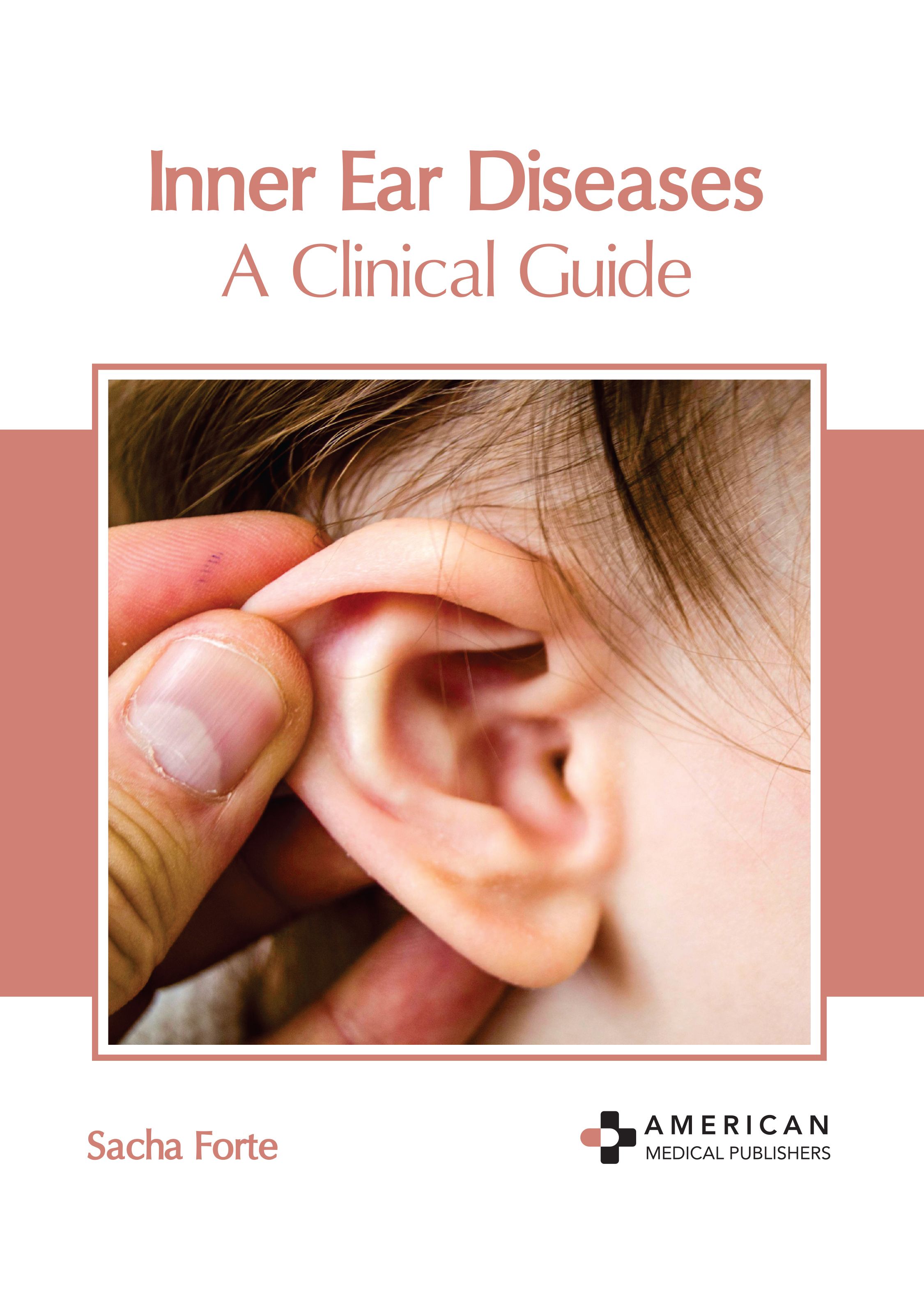 medical-reference-books/otolarngology/inner-ear-diseases-a-clinical-guide-9798887402154
