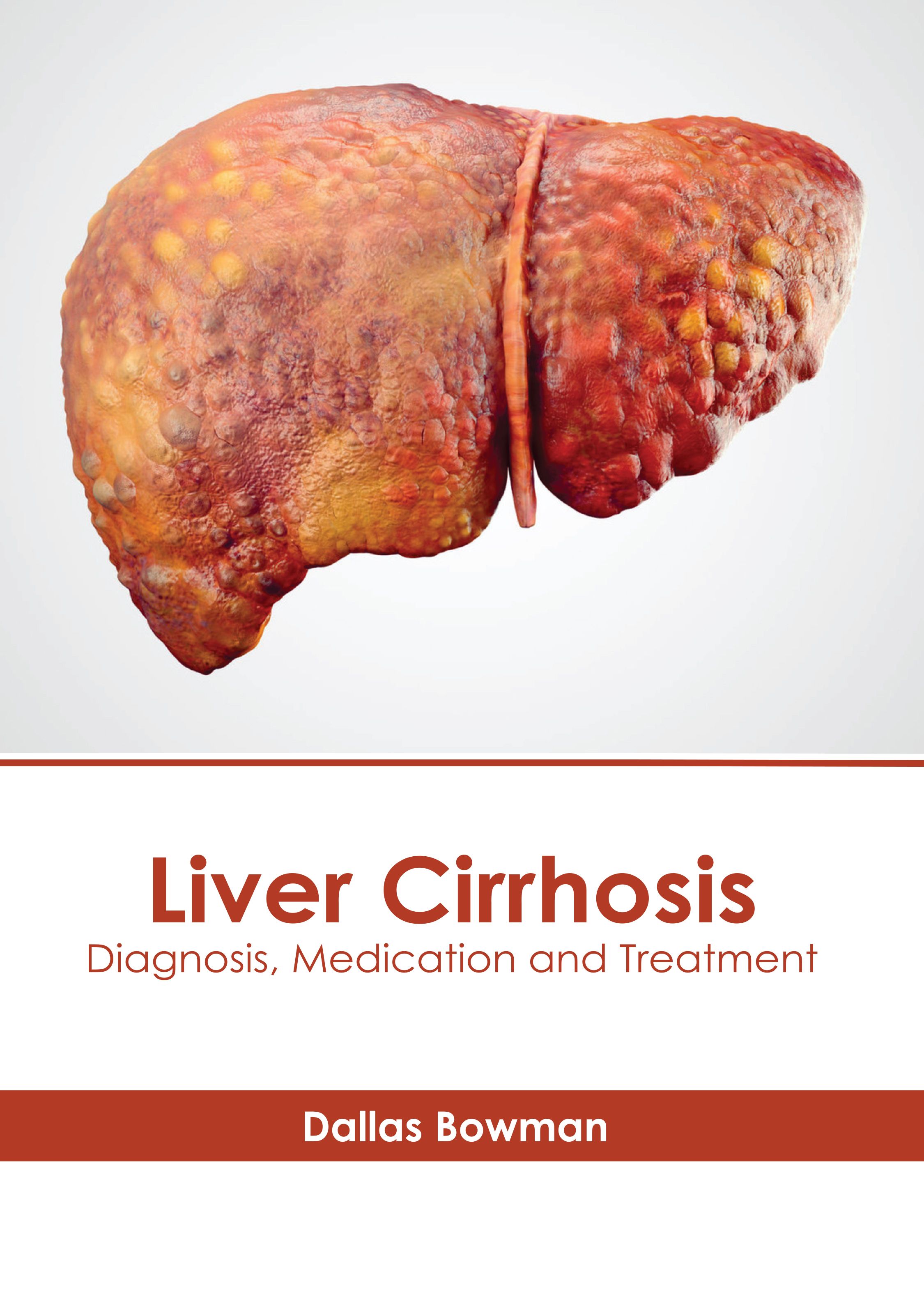 

exclusive-publishers/american-medical-publishers/liver-cirrhosis-diagnosis-medication-and-treatment-9798887402314