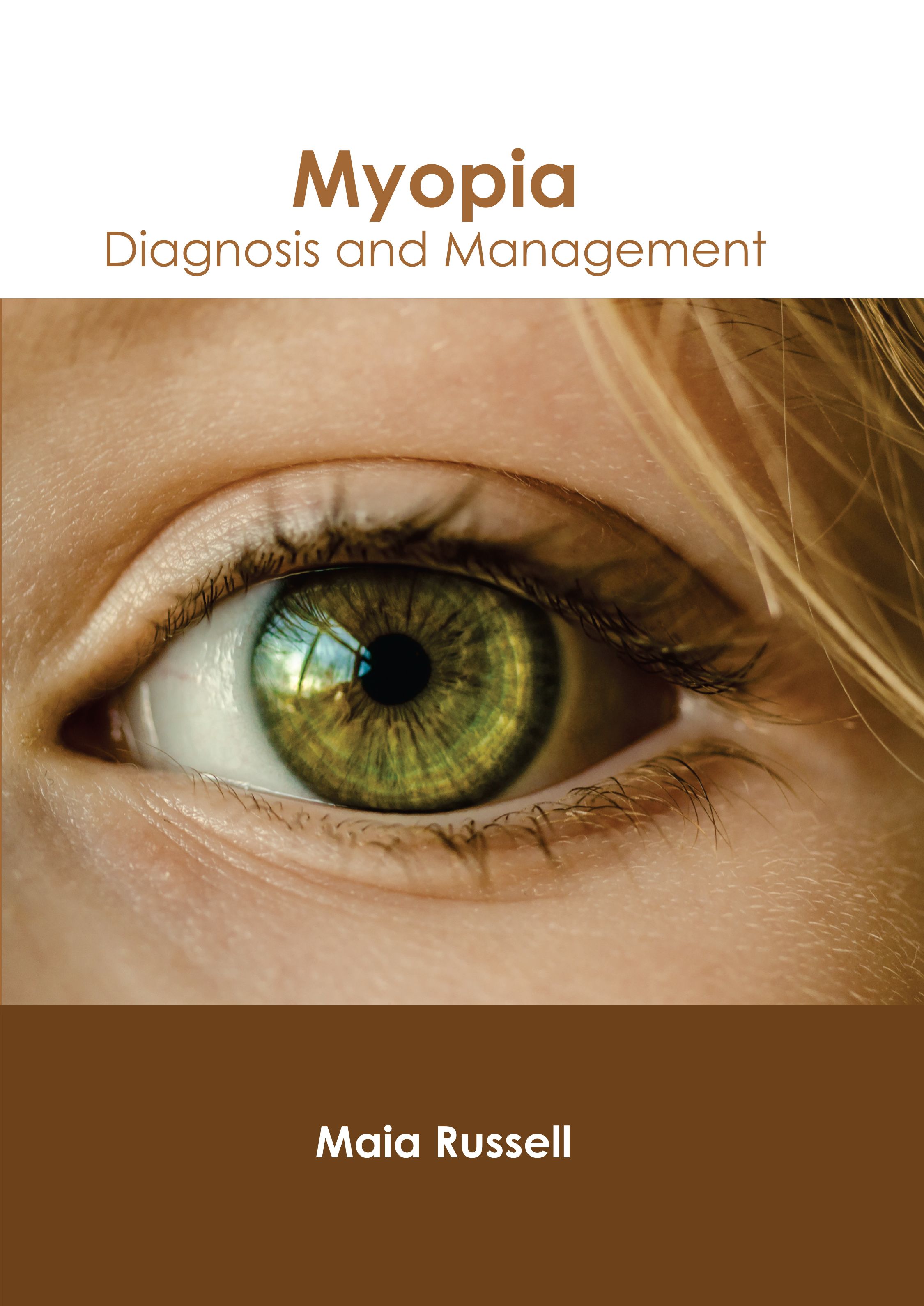 

exclusive-publishers/american-medical-publishers/myopia-diagnosis-and-management-9798887402864