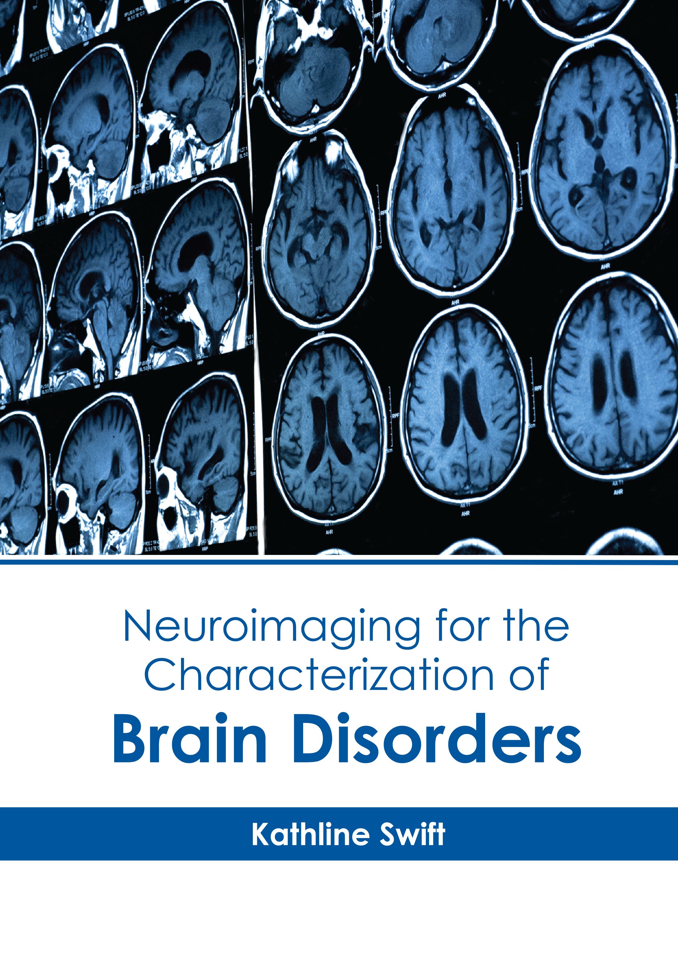 

exclusive-publishers/american-medical-publishers/neuroimaging-for-the-characterization-of-brain-disorders-9798887403083