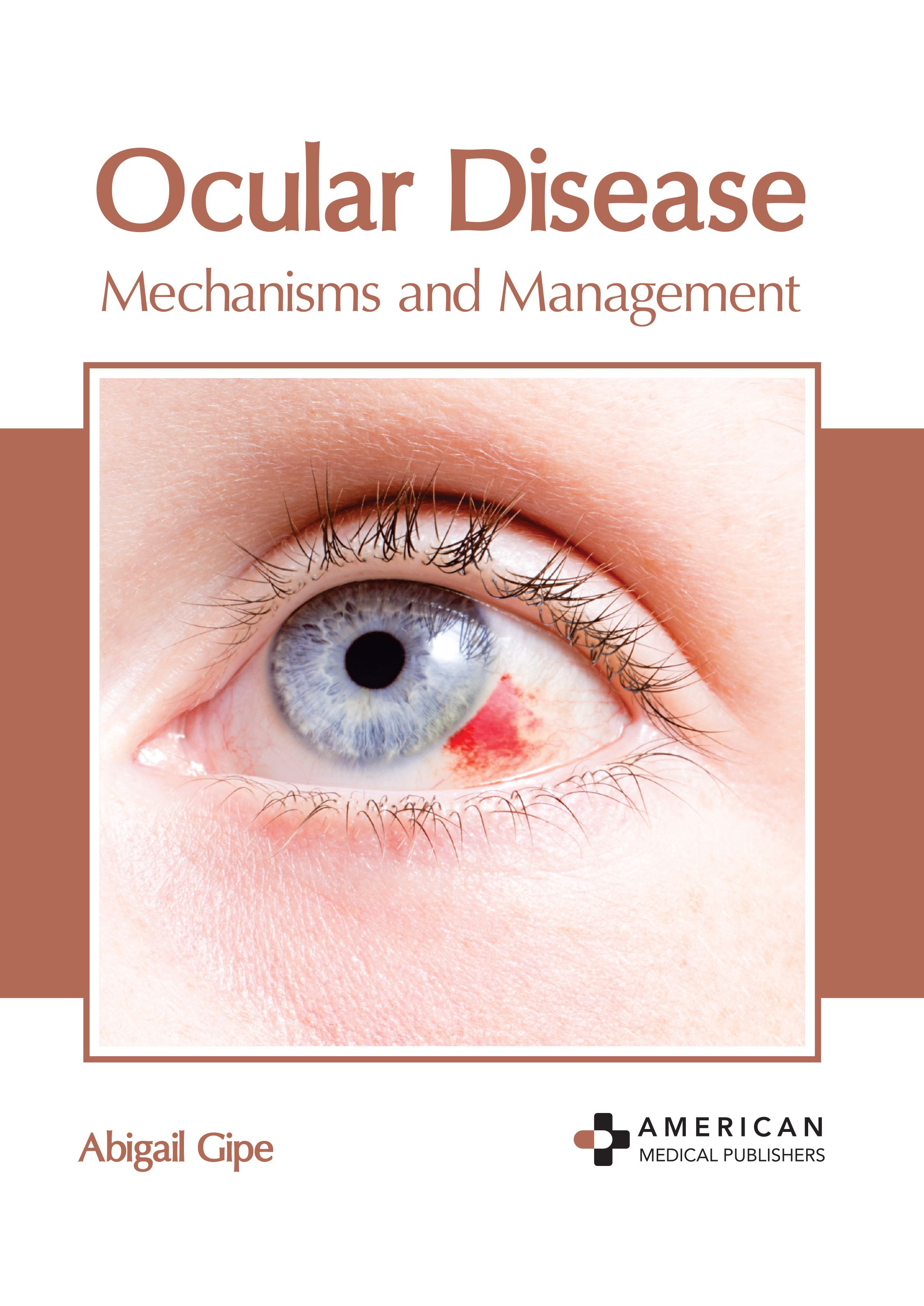 

exclusive-publishers/american-medical-publishers/ocular-disease-mechanisms-and-management-9798887403489