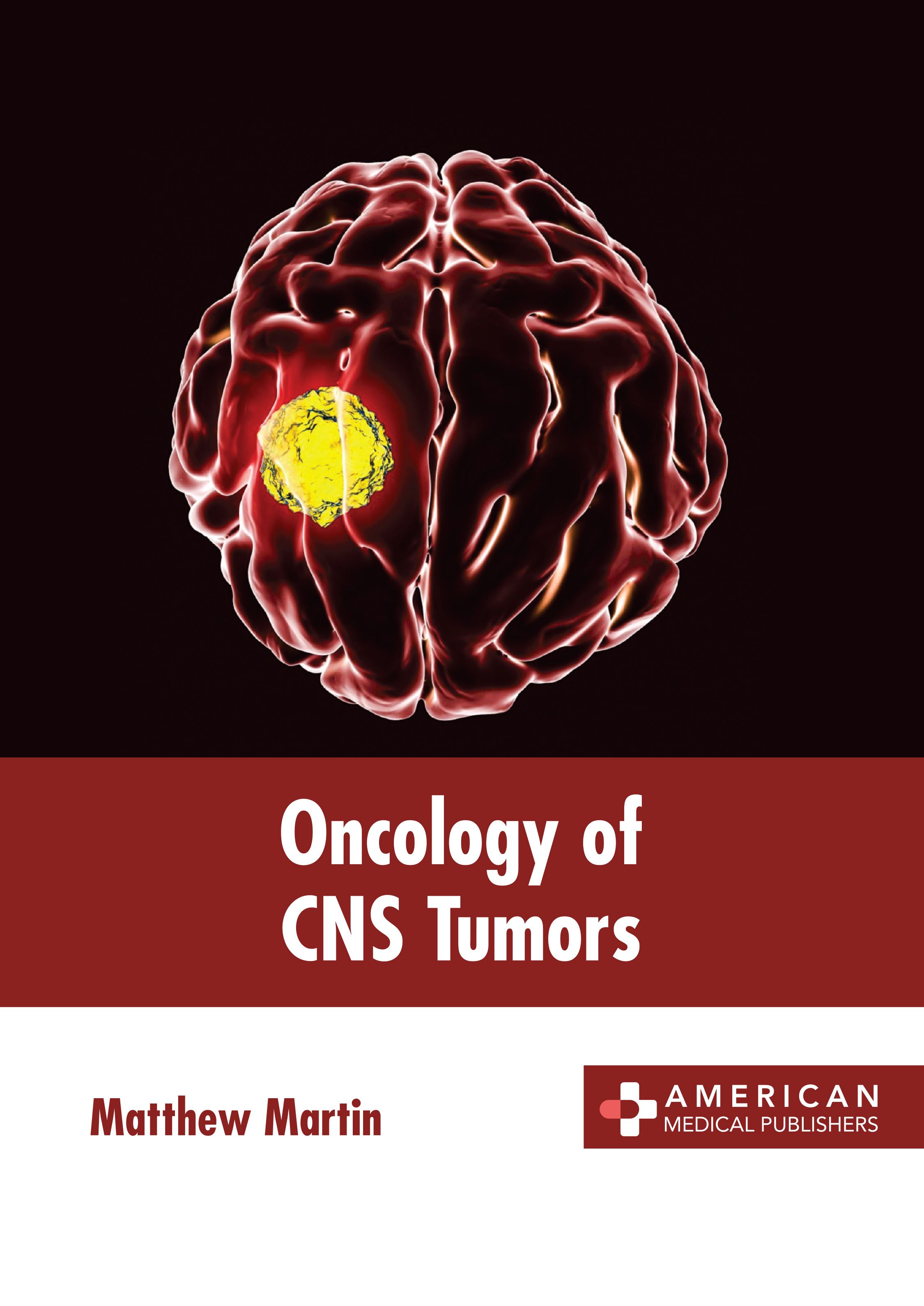 

exclusive-publishers/american-medical-publishers/oncology-of-cns-tumors-9798887403502