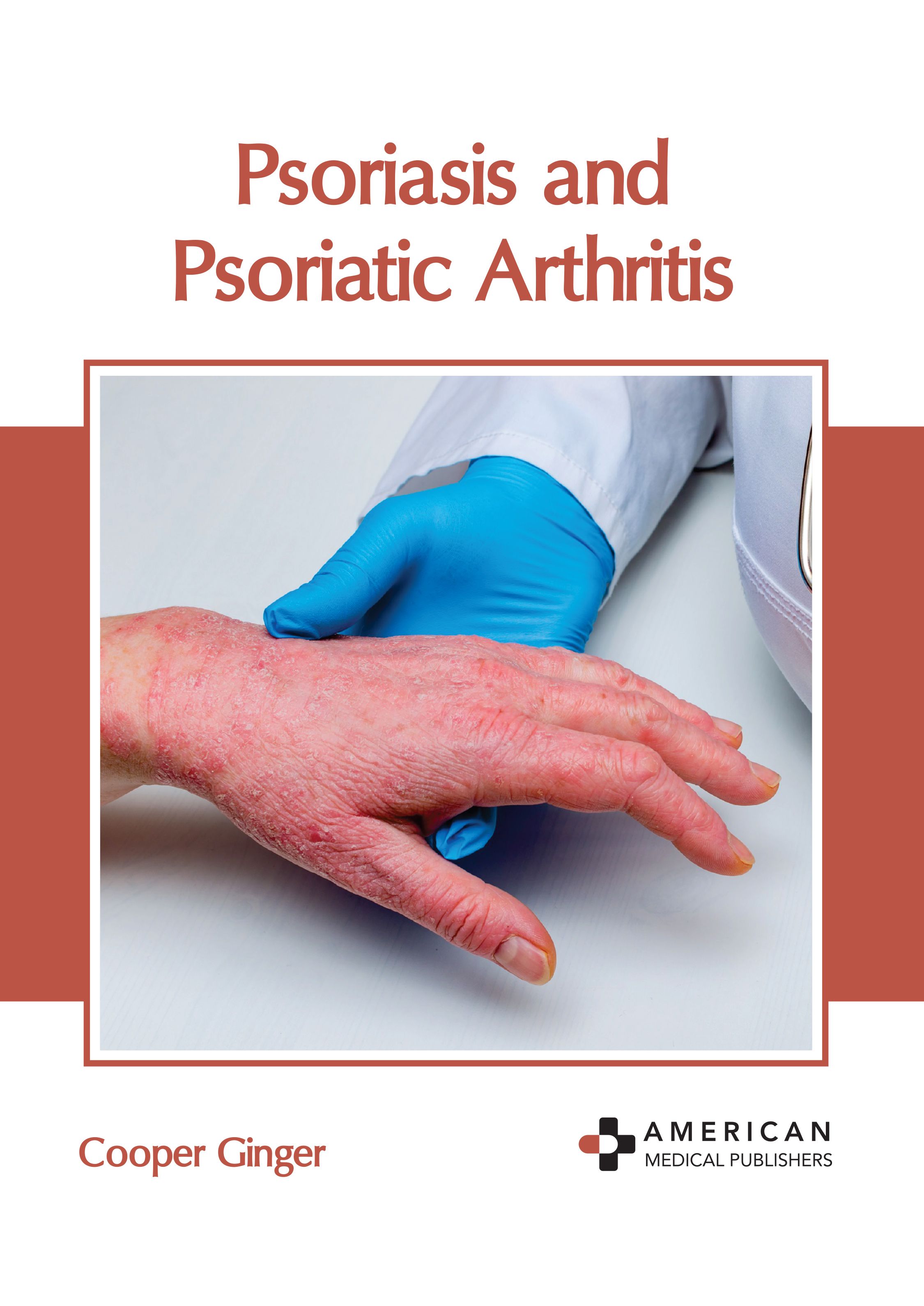 

exclusive-publishers/american-medical-publishers/psoriasis-and-psoriatic-arthritis-9798887404035