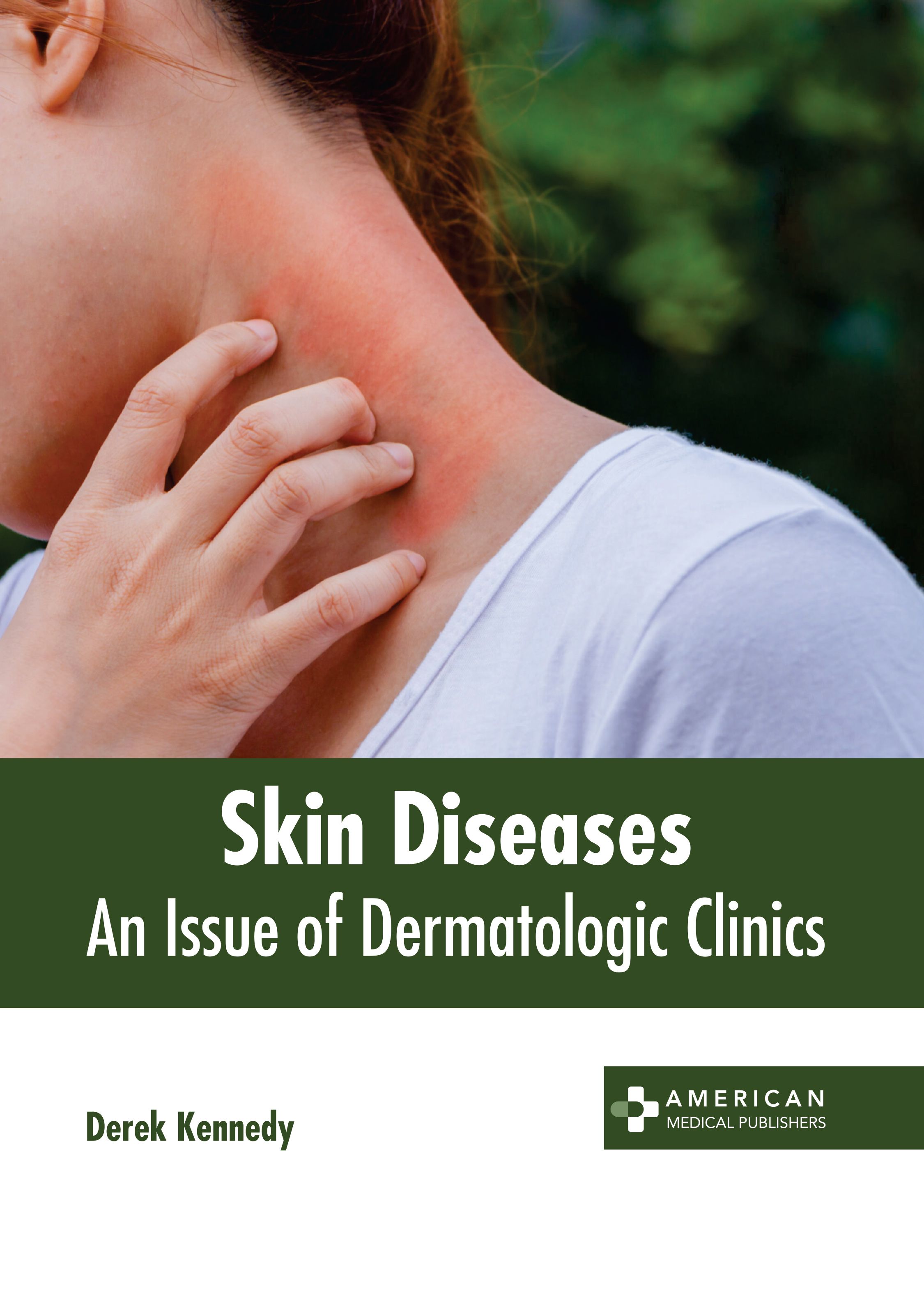 

exclusive-publishers/american-medical-publishers/skin-diseases-an-issue-of-dermatologic-clinics-9798887404585
