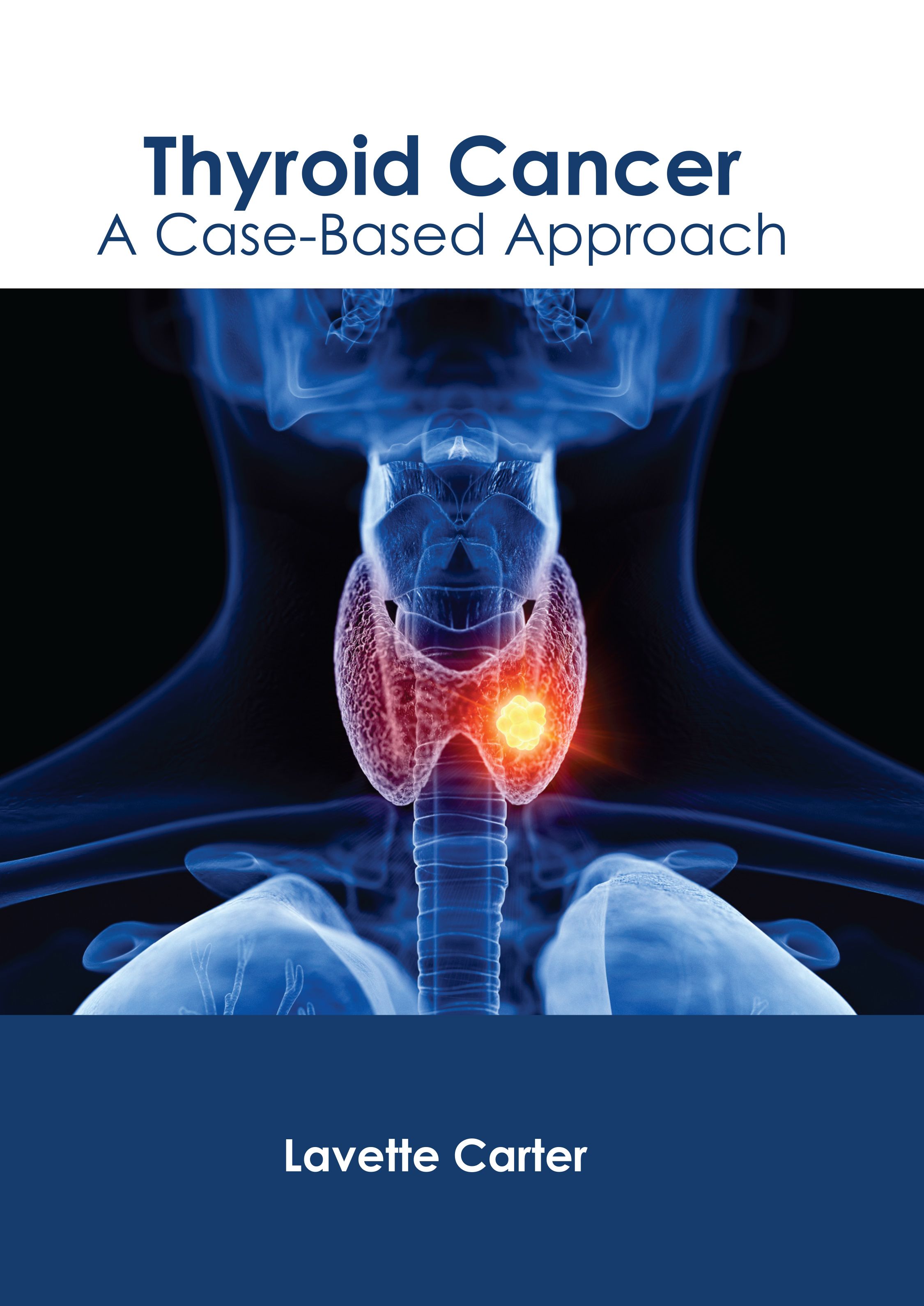 

exclusive-publishers/american-medical-publishers/thyroid-cancer-a-case-based-approach-9798887405087