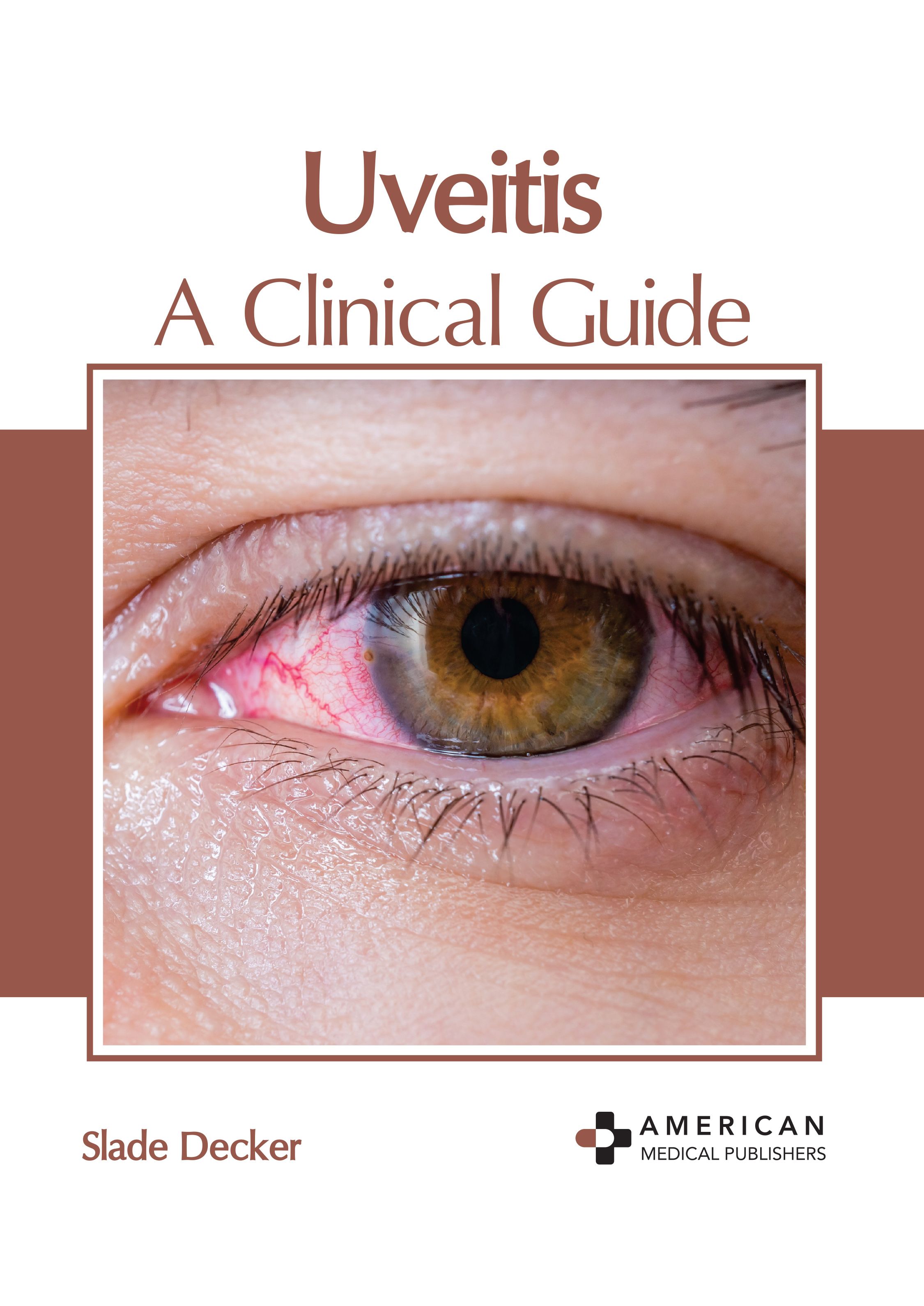 

medical-reference-books/ophthalmology/uveitis-a-clinical-guide-9798887405506