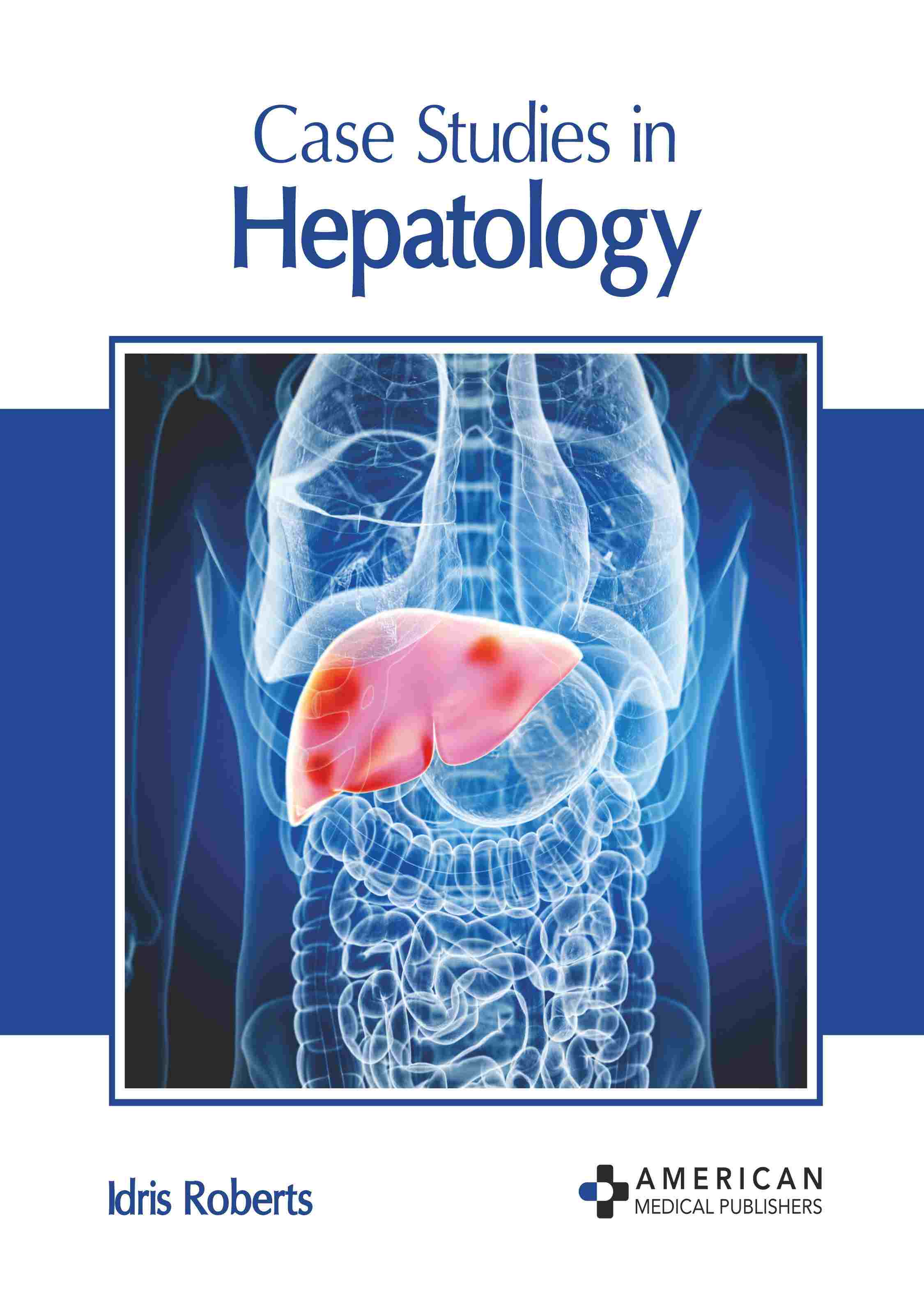 

exclusive-publishers/american-medical-publishers/case-studies-in-hepatology-9798887406039