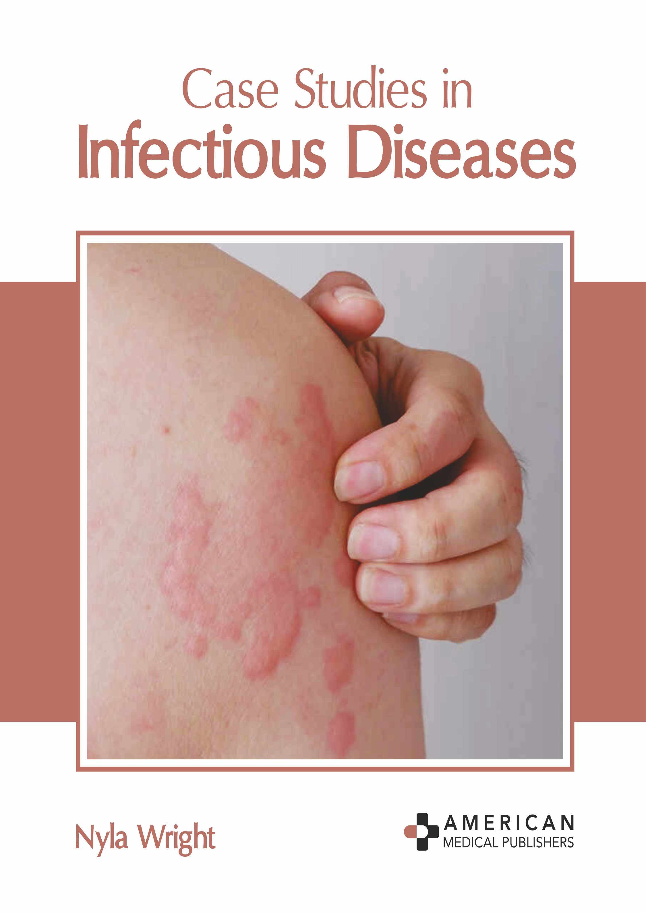

exclusive-publishers/american-medical-publishers/case-studies-in-infectious-diseases-9798887406060