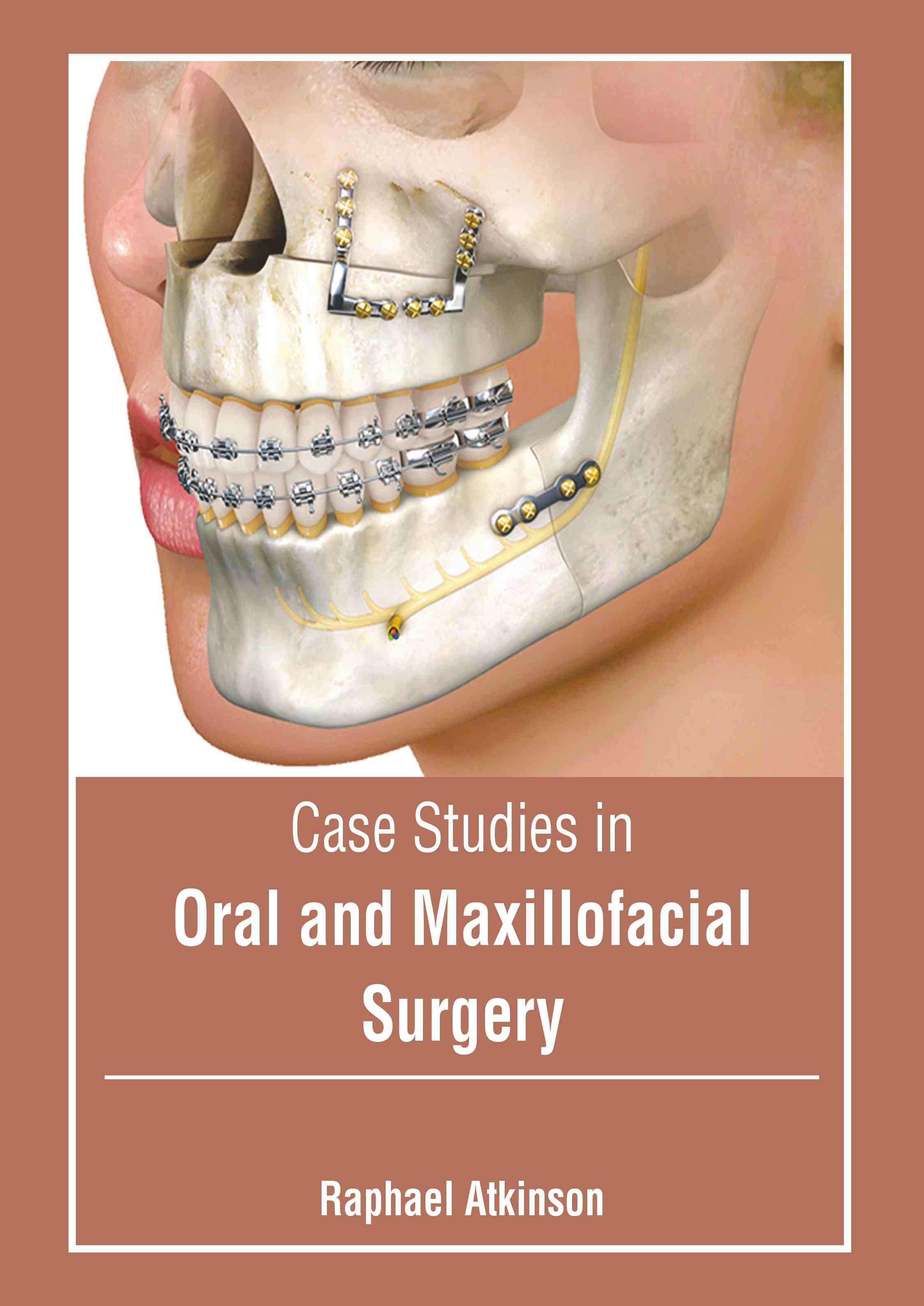 

exclusive-publishers/american-medical-publishers/case-studies-in-oral-and-maxillofacial-surgery-9798887406114