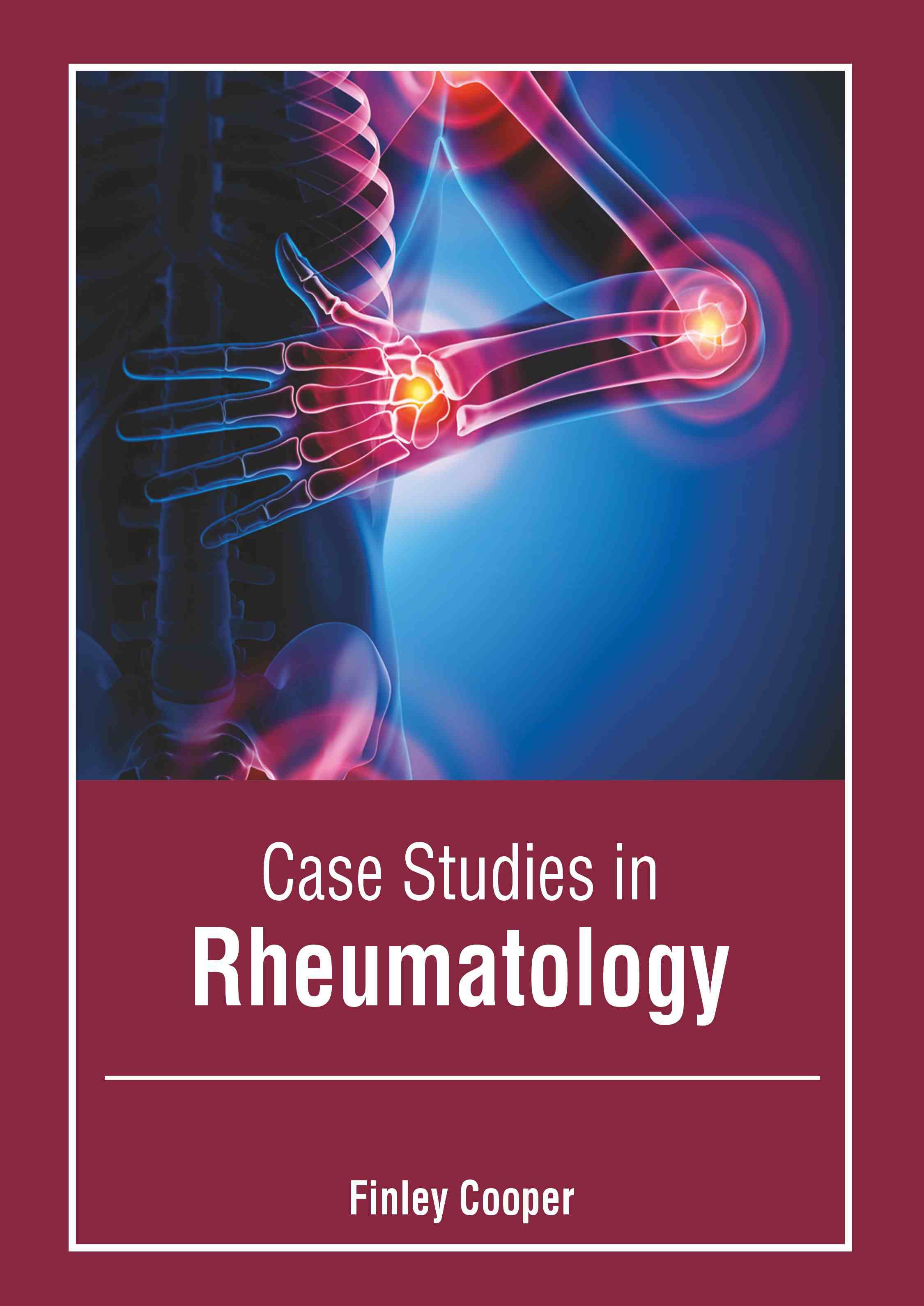 

exclusive-publishers/american-medical-publishers/case-studies-in-rheumatology-9798887406152