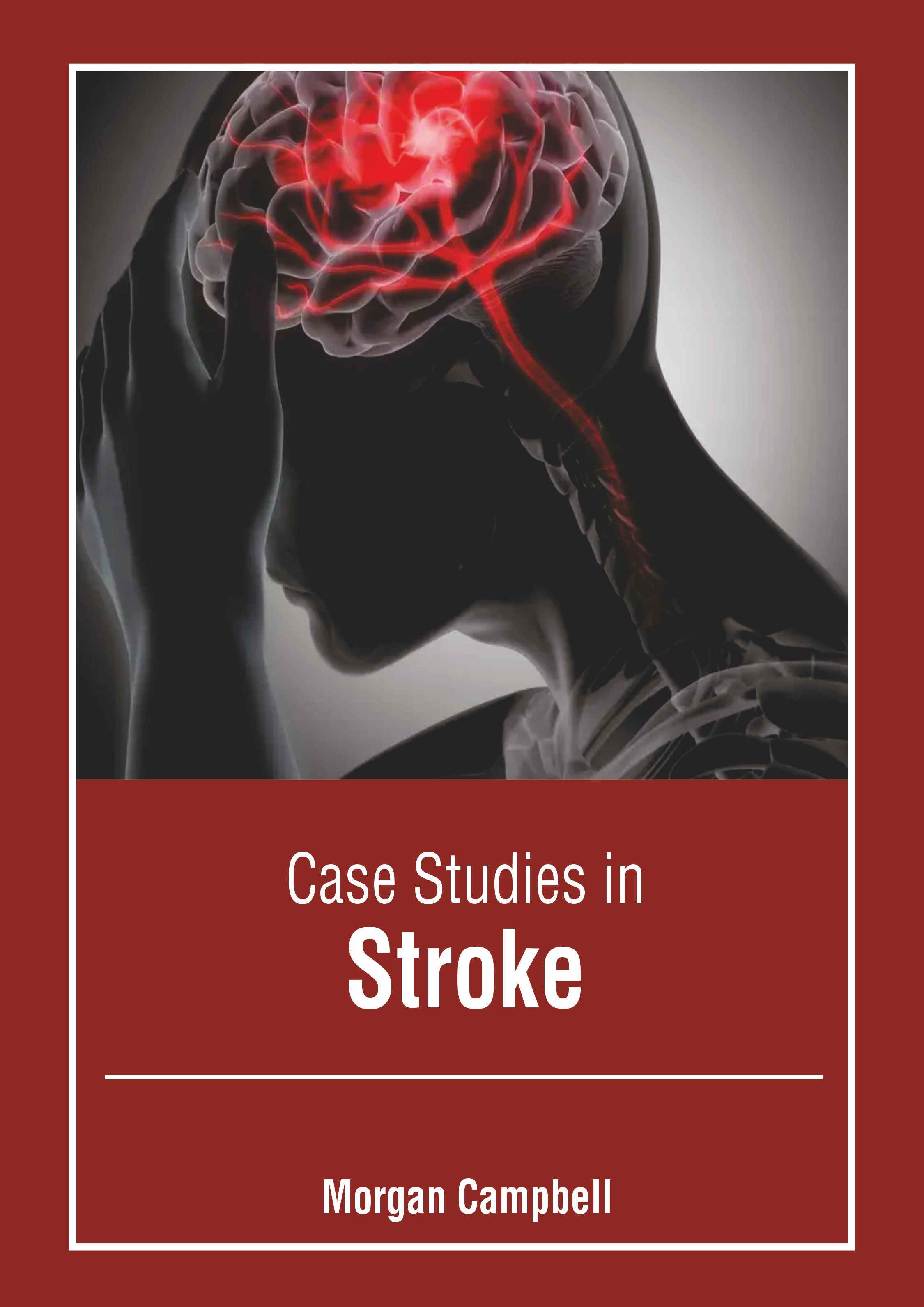 

exclusive-publishers/american-medical-publishers/case-studies-in-stroke-9798887406169